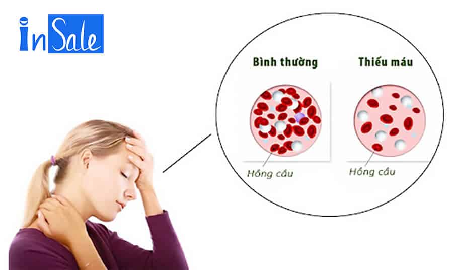 Hồng sấy dẻo giúp điều trị thiếu máu