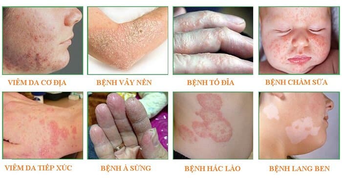 Serum Trần Mao trị các bệnh về da